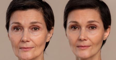 antiaging-beauty-treatment-1-scaled antiaging-beauty-treatment-1-scaled